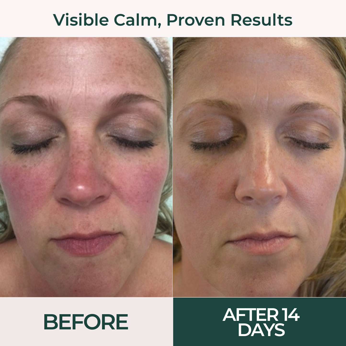 Kälm Skin Repair Serum